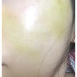 ニューセンス皮膚科クリニック口コミ