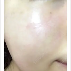ニューセンス皮膚科クリニック口コミ