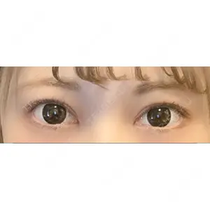 口コミ