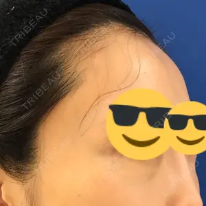 東京イセアクリニック口コミ