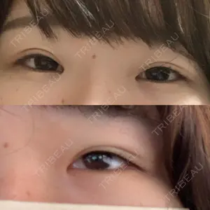 湘南美容クリニック 湘南美容クリニック 京都院口コミ