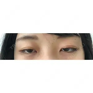 口コミ