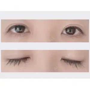 プロミス整形外科口コミ