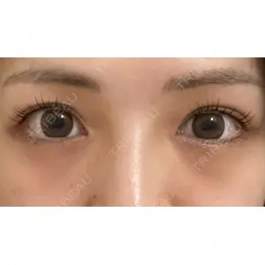 APOLLO BEAUTY CLINIC口コミ