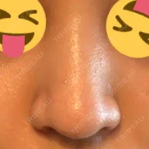 聖心美容クリニック グループ 聖心美容クリニック 六本木院口コミ