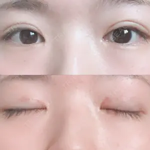 R.O.clinic口コミ