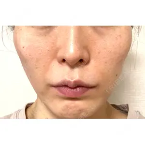 口コミ