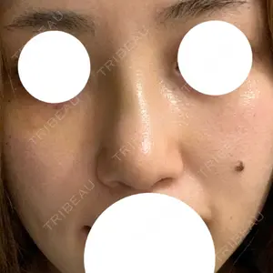 口コミ