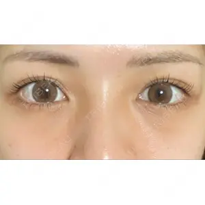 APOLLO BEAUTY CLINIC口コミ