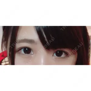 かめい美容クリニック宇都宮口コミ