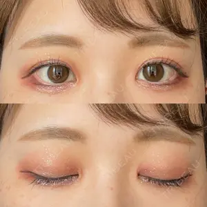 口コミ