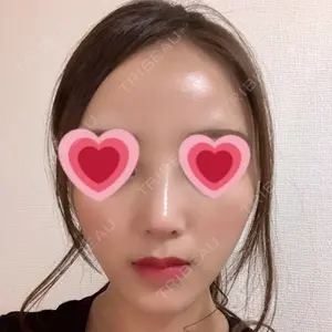 口コミ