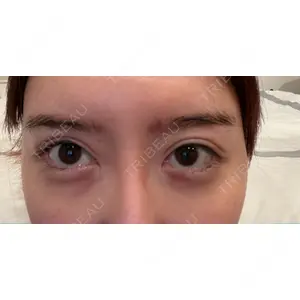 A CLINIC（エークリニック） A CLINIC（エークリニック） 銀座院口コミ