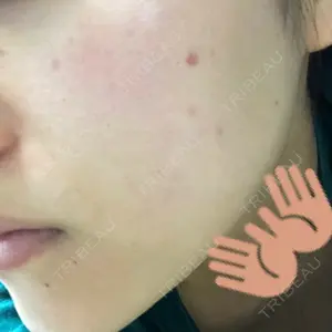 abijouクリニック口コミ