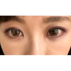 湘南美容クリニック 湘南美容クリニック 橋本院口コミ