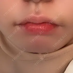 ルラ美容クリニック ルラ美容クリニック 高田馬場院口コミ