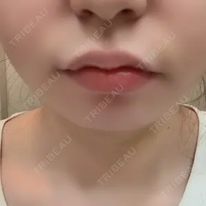 ルラ美容クリニック ルラ美容クリニック 高田馬場院口コミ