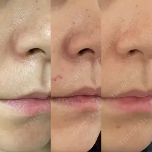 ウィルクリニック口コミ