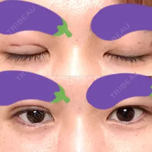 口コミ