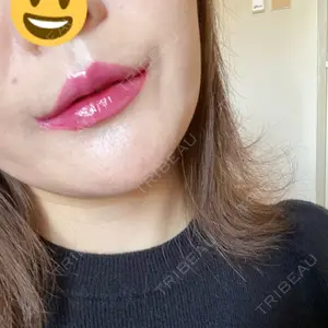 くさのたろうクリニック口コミ