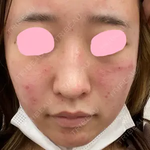 UB CLINIC銀座口コミ