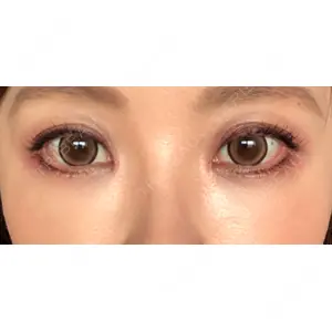 湘南美容クリニック 湘南美容クリニック 橋本院口コミ