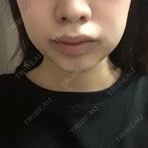 口コミ