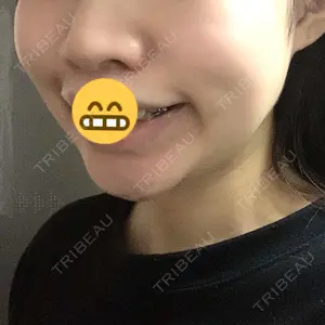 口コミ