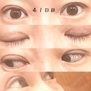 口コミ