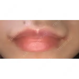 聖心美容クリニック グループ 聖心美容クリニック 六本木院口コミ