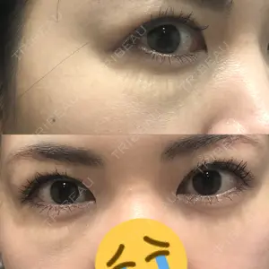 口コミ