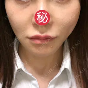 東京エビスクリニック口コミ
