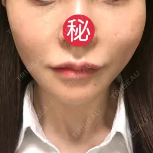 東京エビスクリニック口コミ