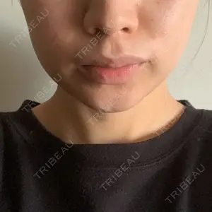 口コミ