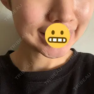 口コミ