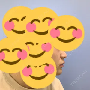 湘南美容クリニック 湘南美容クリニック 池袋西口院口コミ