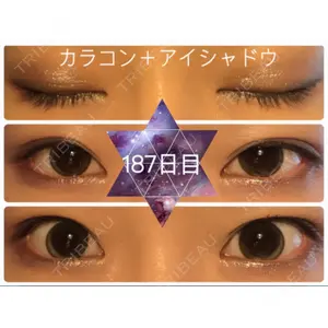口コミ