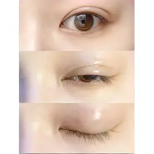 R.O.clinic口コミ