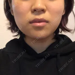 口コミ