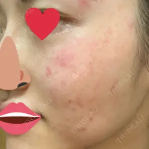 南青山TOKUNAKAクリニック口コミ