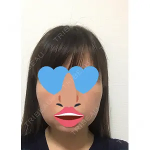 湘南美容クリニック 湘南美容クリニック 池袋西口院口コミ