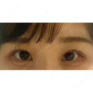 口コミ