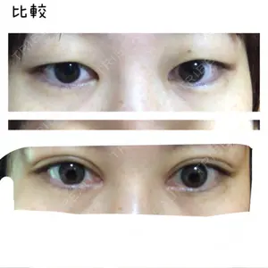 いちのせ形成外科・皮膚科 眼瞼＆フェイスクリニック口コミ