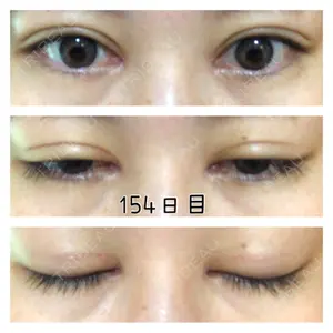 いちのせ形成外科・皮膚科 眼瞼＆フェイスクリニック口コミ
