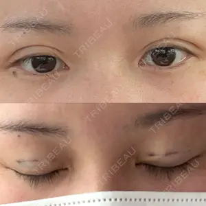 湘南美容クリニック 湘南美容クリニック 熊本院口コミ