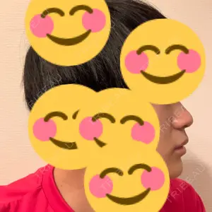 湘南美容クリニック 湘南美容クリニック 池袋西口院口コミ