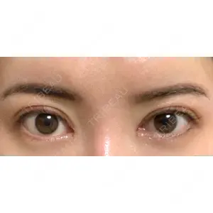 いちのせ形成外科・皮膚科 眼瞼＆フェイスクリニック口コミ