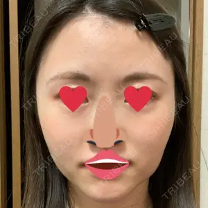 口コミ