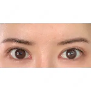 いちのせ形成外科・皮膚科 眼瞼＆フェイスクリニック口コミ