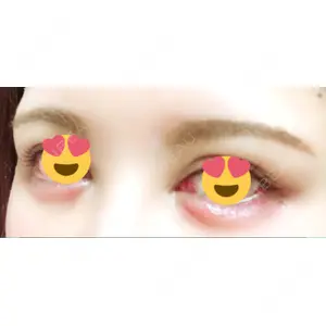 口コミ